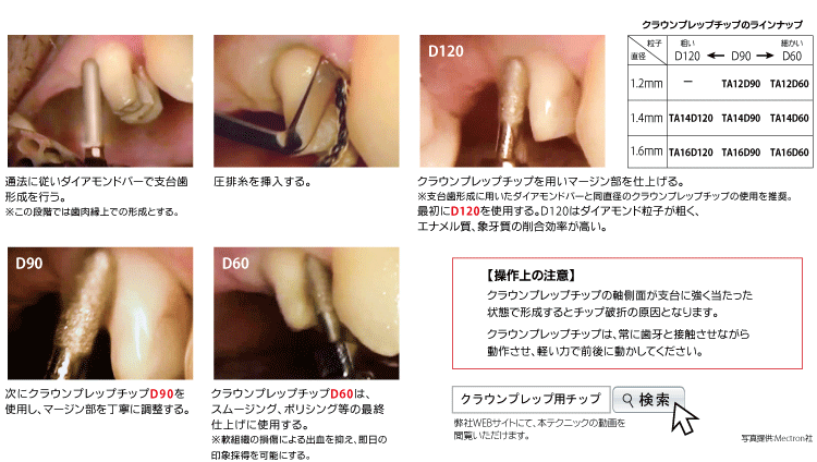 ピエゾサージェリー タッチ ベーシック1｜株式会社インプラテックスの