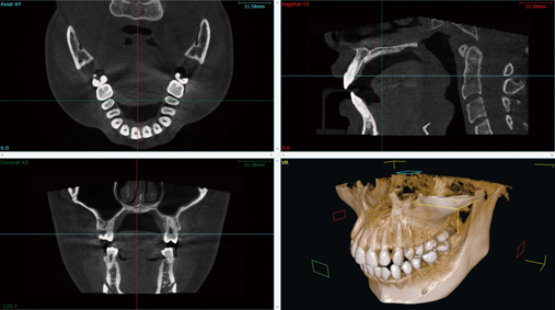 歯科用デジタルX線CT NAOMI-CT | 武豊町の歯医者｜ふき歯科クリニック