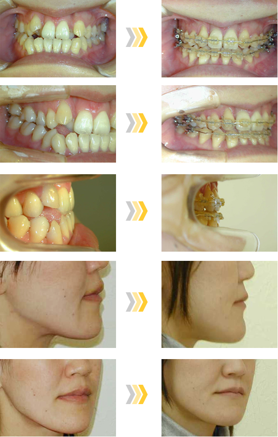 イワセ歯科・矯正歯科クリニック｜宝塚市・逆瀬川の歯医者・歯科