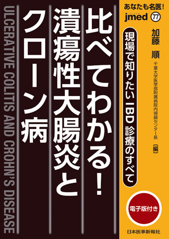 あなたも名医！現場で知りたいIBD診療のすべて 比べてわかる！潰瘍性