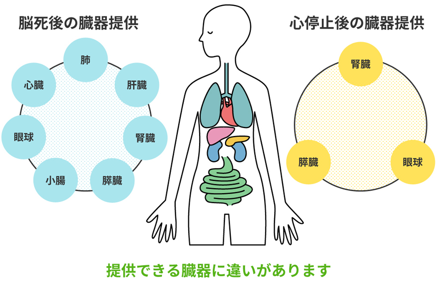 脳死後と心停止後の臓器提供の違い｜日本臓器移植ネットワーク