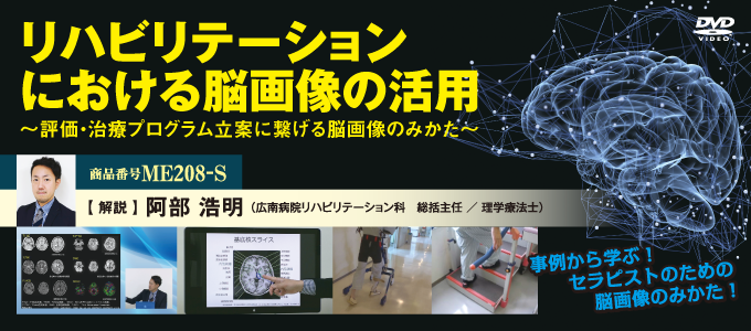 リハビリテーションにおける脳画像の活用～ 評価・治療プログラム立案