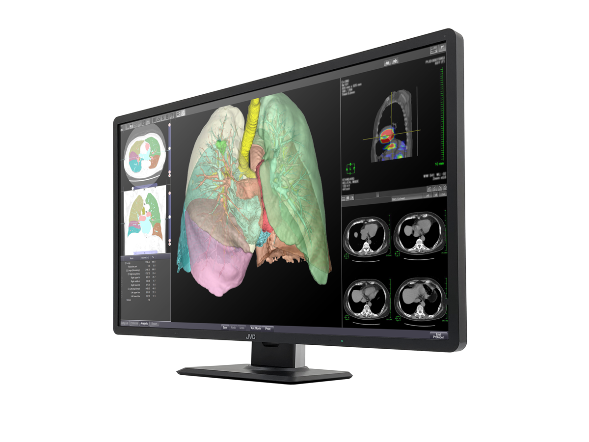 800万画素32型カラー液晶モニターCL-R813 | 医用モニター / 産業用