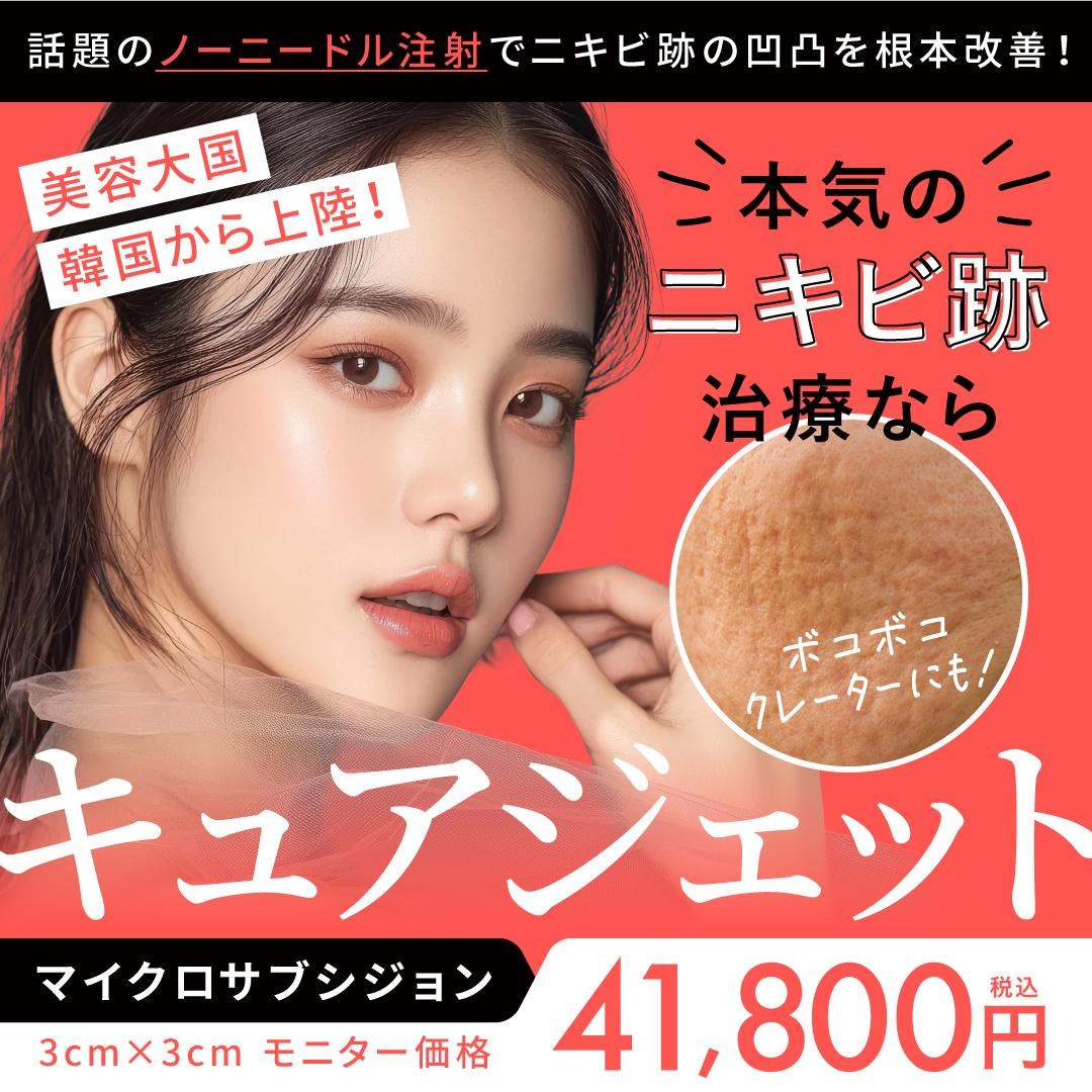 クレーター治療におすすめ！キュアジェット「マイクロサブシジョン」と