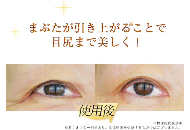 公式】『リッドキララ』まぶたには、まぶたの最終手段