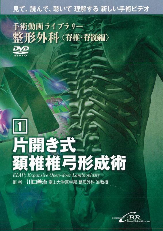 DVD】 片開き式頚椎椎弓形成術 ELAP; Expansive Open-door