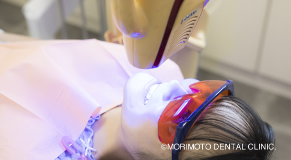 ホワイトニング 前歯を白くするビヨンドポーラス | 久留米市