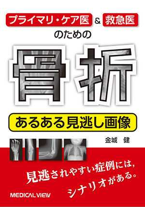 メジカルビュー社｜整形外科｜スタンダード骨折手術治療 スタンダード