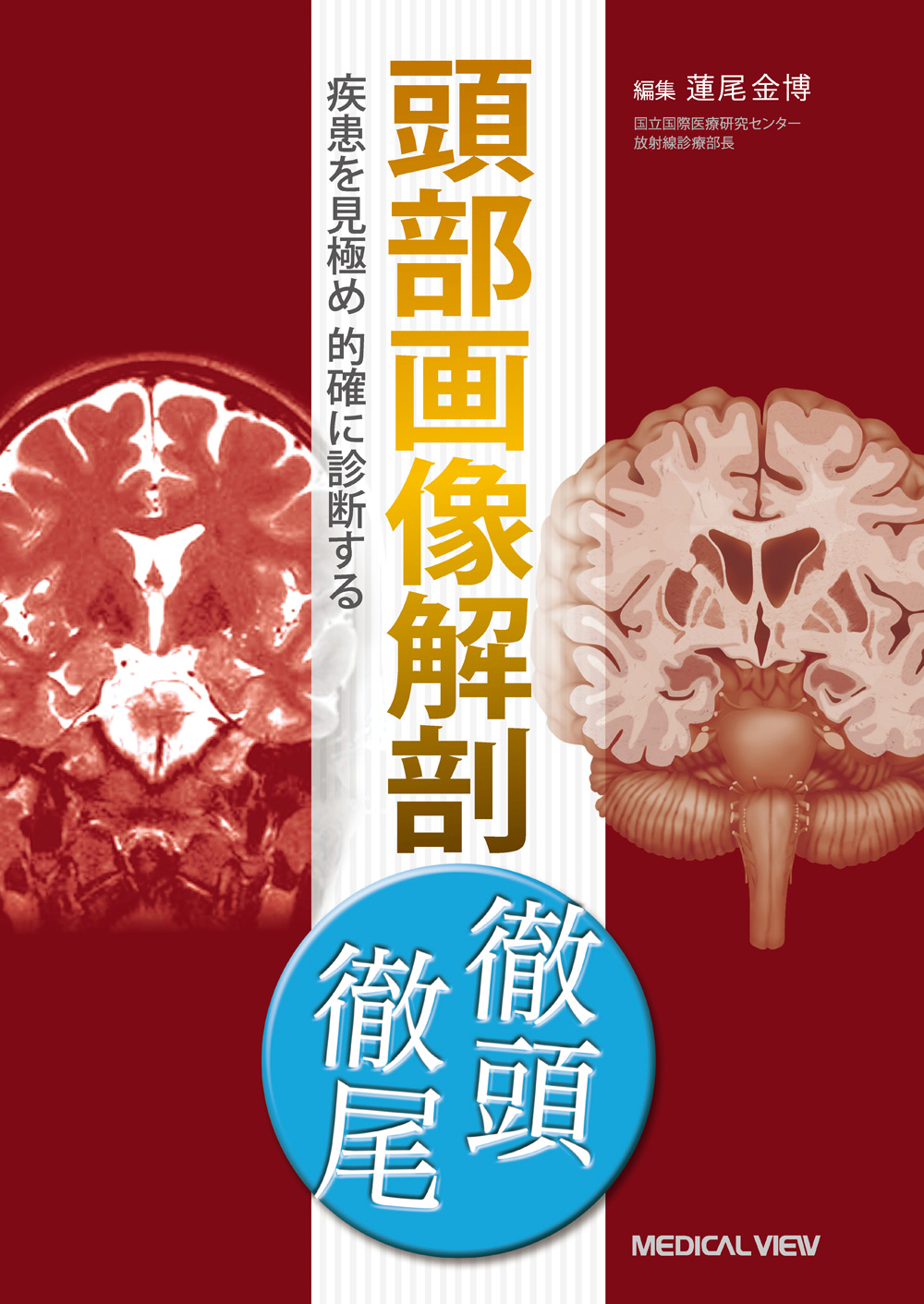 メジカルビュー社｜画像医学・放射線医学｜画像解剖 徹頭徹尾 頭部画像