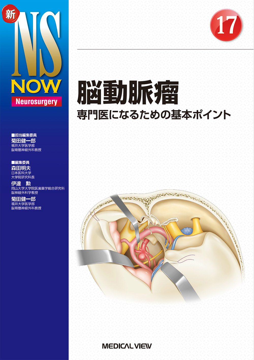 メジカルビュー社｜脳神経外科｜新NS NOW 17 脳動脈瘤