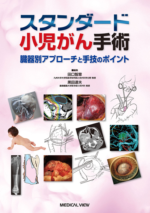 メジカルビュー社｜小児外科｜スタンダード小児がん手術