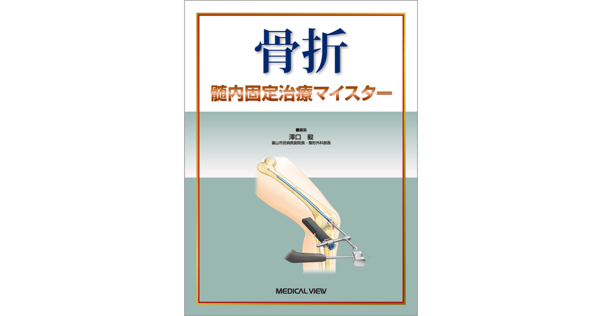メジカルビュー社｜整形外科｜骨折 髄内固定治療マイスター