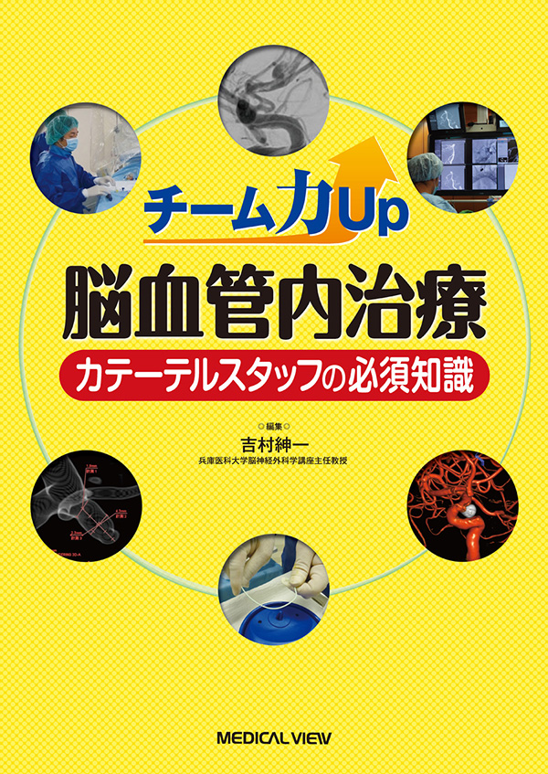 メジカルビュー社｜脳神経外科｜脳血管内治療