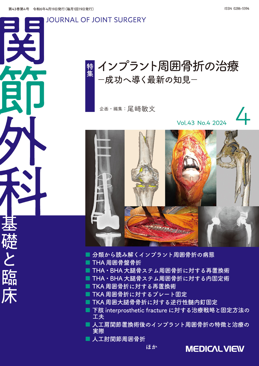 メジカルビュー社｜関節外科特集一覧｜関節外科 2024年4月号
