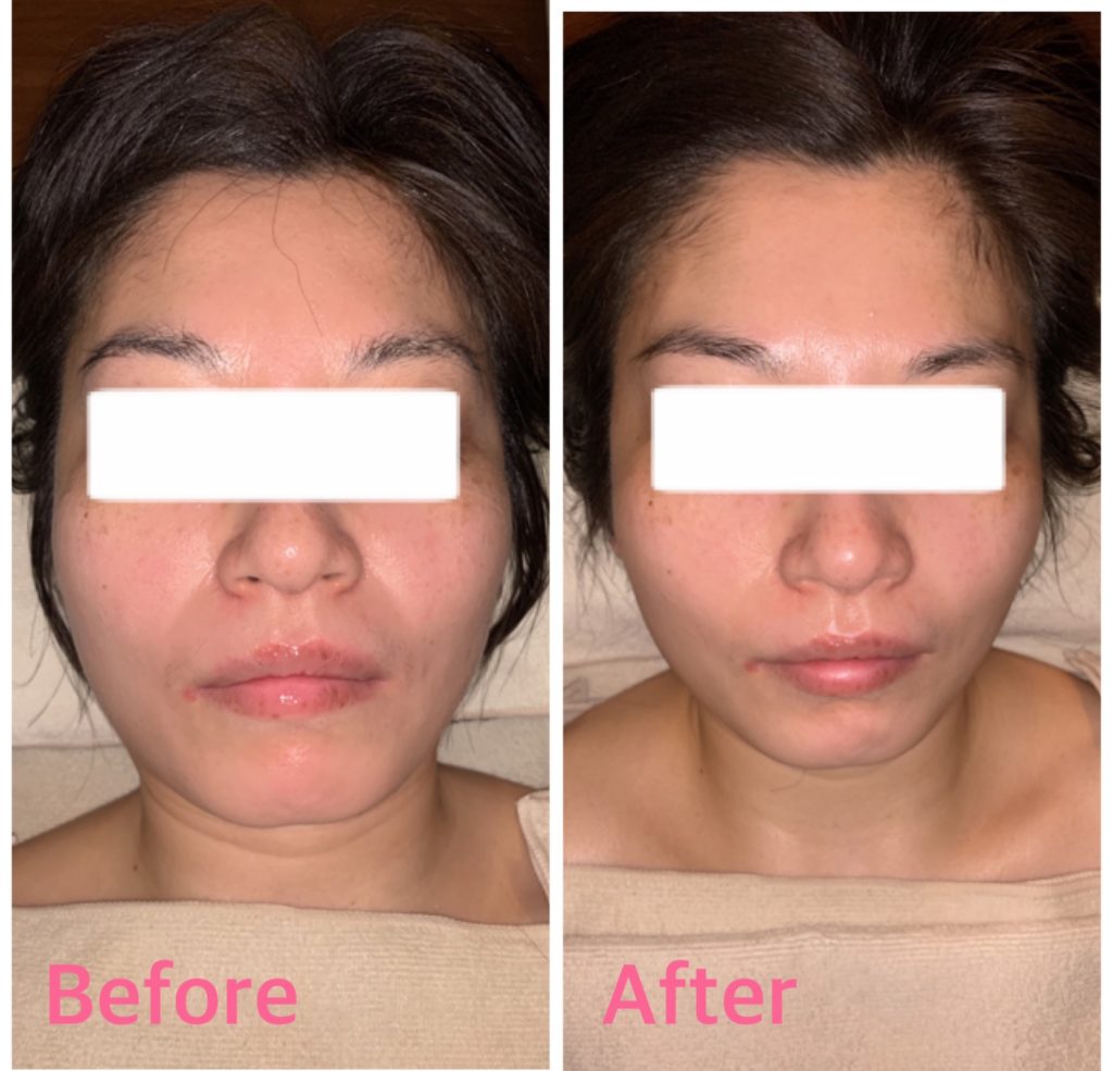 パーフェクトアクアリーボーテ パーフェクトアクアリーボーテ 美容液