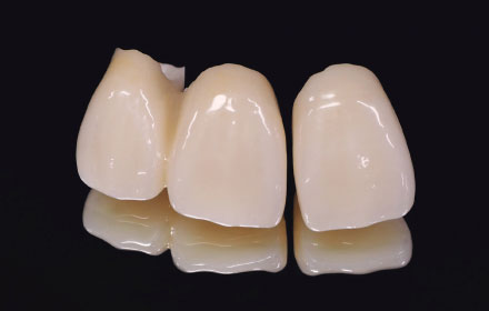 審美修復治療・ホワイトニング｜診療案内｜北高崎駅近くの歯医者