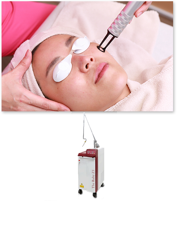 大阪でQスイッチルビーレーザーが1,100円【MAクリニック心斎橋】