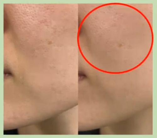 MAJOR | 2025年 マジョール タイムレスリペアクリーム 50g