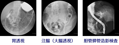 X線透視検査｜放射線科｜三重北医療センター菰野厚生病院公式サイト