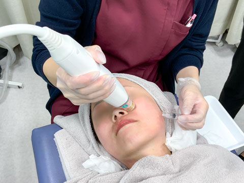 マイクロニードルRF美肌治療「POTENZA(ポテンツァ)」| ハニー