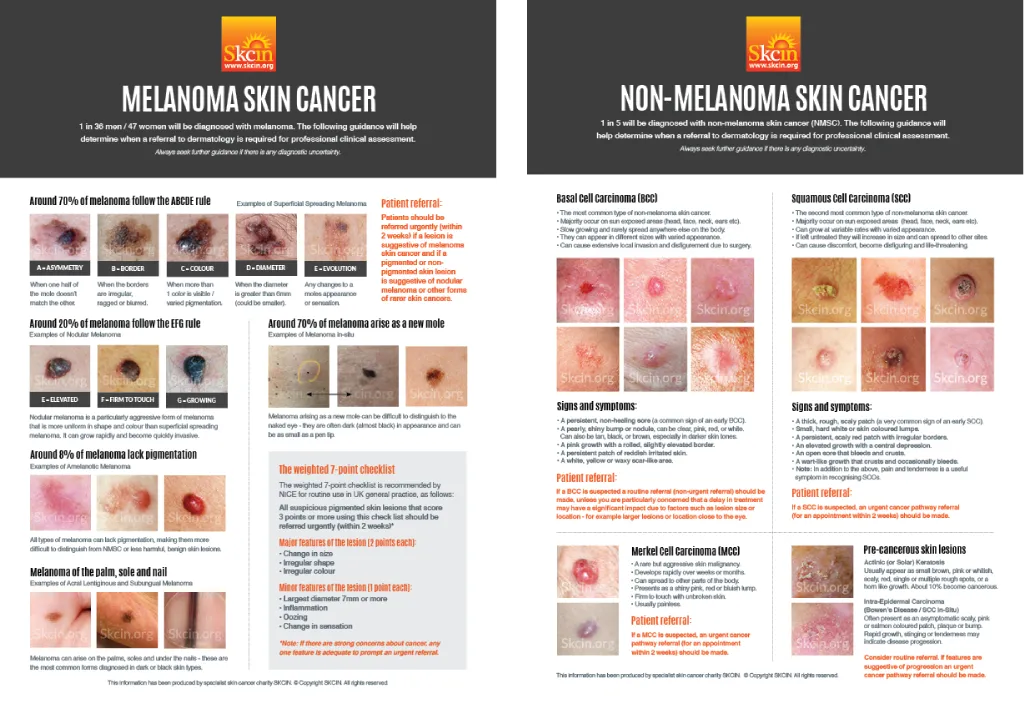 肌チェッカー／皮膚分析機器｜株式会社ヤヨイ（公式ホームページ） 業務用