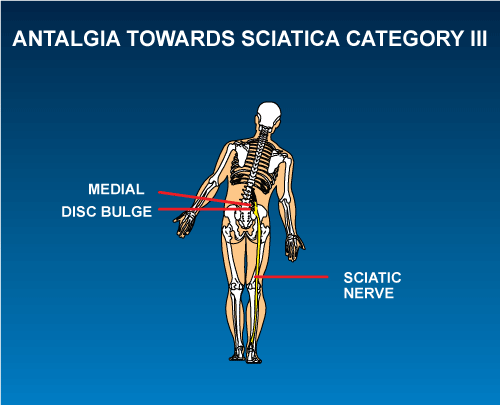 Sacral Occipital Technique Overview | Sunset Chiropractic | South