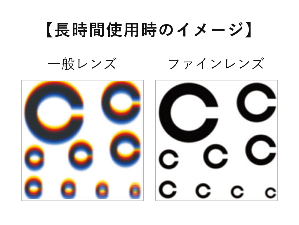 FINE LENS｜Surgitel～拡大鏡サージテル～歯科専用サイト