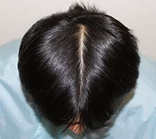 公式】発毛専門 リーブ21