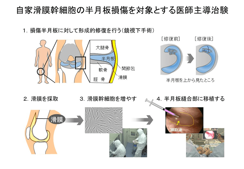 軟骨・半月板創生ユニット | 東京医科歯科大学 先端医歯工学創成研究