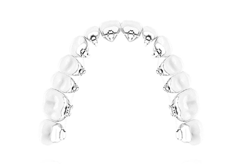 神戸 舌側矯正 リンガル矯正WIN｜うしじま歯科・矯正歯科クリニック