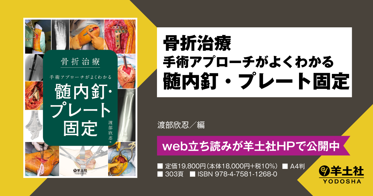 骨折治療 手術アプローチがよくわかる髄内釘・プレート固定 - 羊土社
