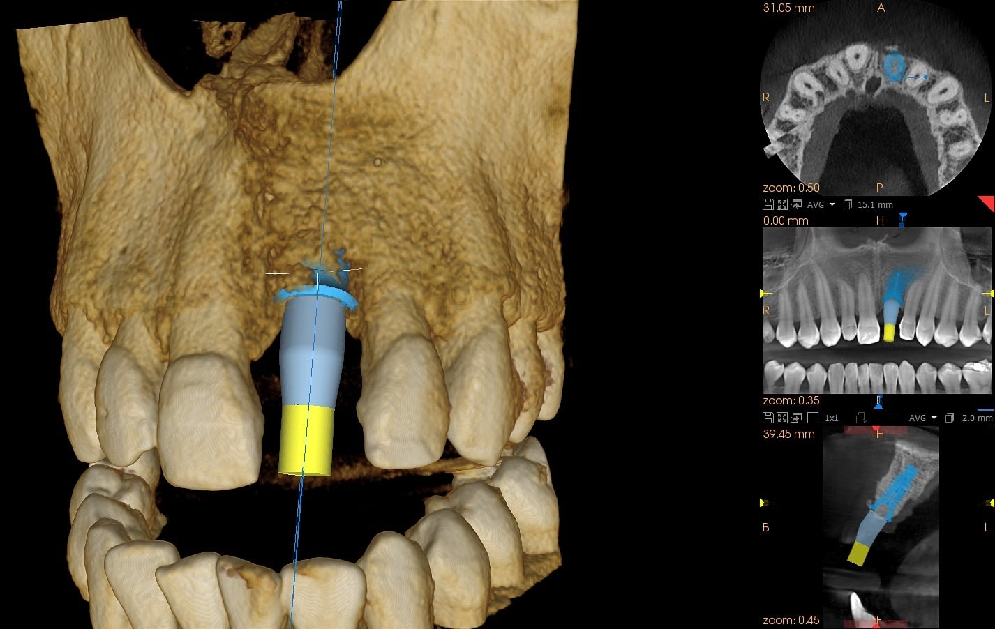 歯科用CT・パノラマ（セファロ追加可能）】KR-8200 3D ｜株式会社近畿