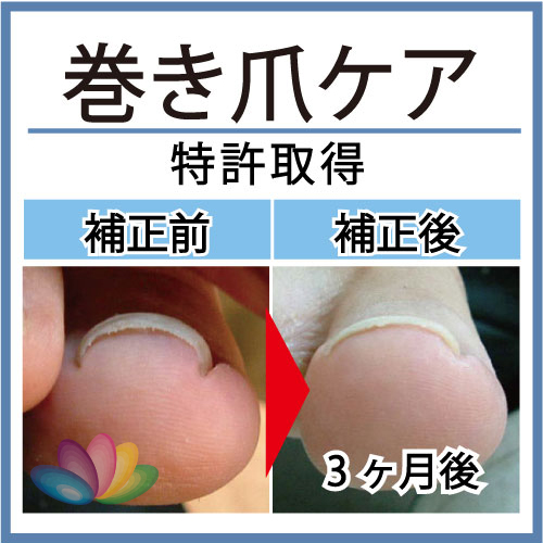 ペディグラス | やまだ皮フ科クリニック