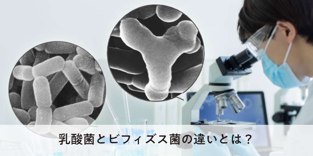 乳酸菌とビフィズス菌の違いとは？｜ヤクルト届けてネット