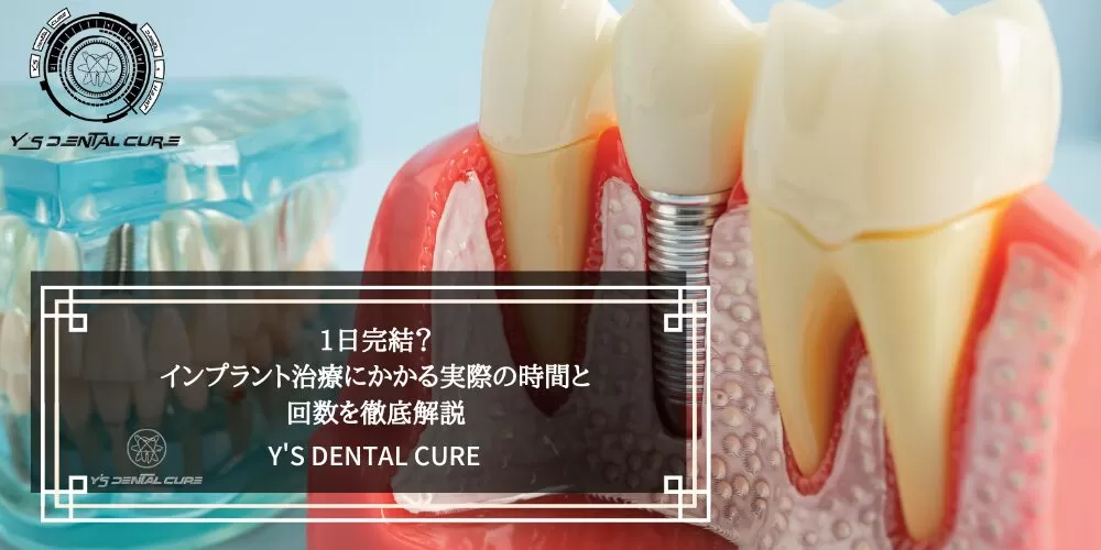 1日完結？インプラント治療にかかる実際の時間と回数を徹底解説 | 医療