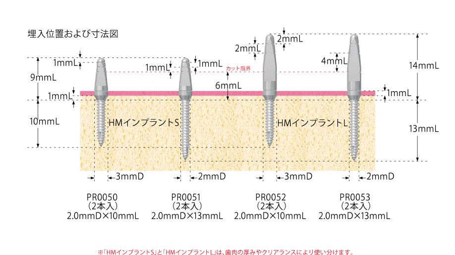 暫間補綴用 HMインプラント｜インプラント｜ジンヴィ・ジャパン