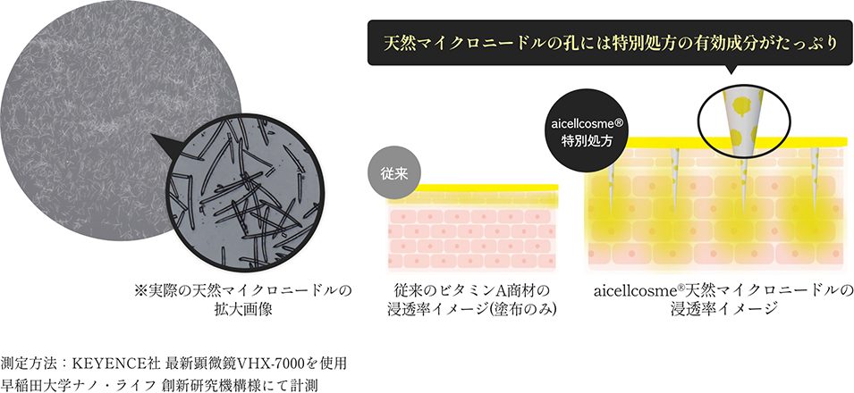 Needle peeling®｜株式会社アイセル｜ニードルピーリング・育肌ハーブ