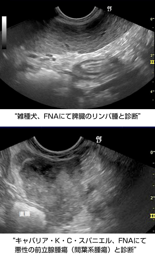 腹部エコー完全習得ガイド～Basic Learning～ | 株式会社 医療情報研究所