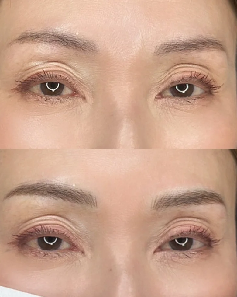 アートメイクマシン カラーベージュ カルテ計3点 アートメイクマシン