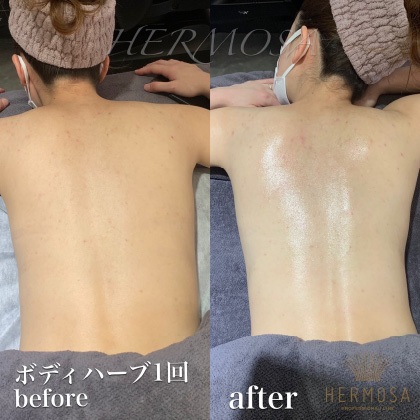 美骨艶肌サロン TORIE（トリエ） | HERMOSA