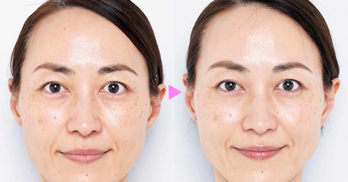 2024年新作】47歳主婦が「ポーラ名品美白美容液」を2週間試してみた