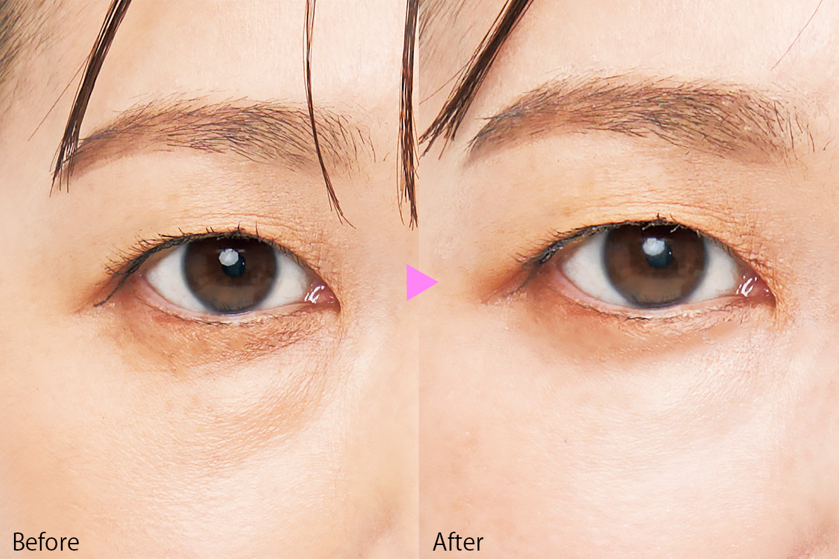 絶対に失敗しない美顔器】1回の使用で小顔になれる!?実際に試してみた