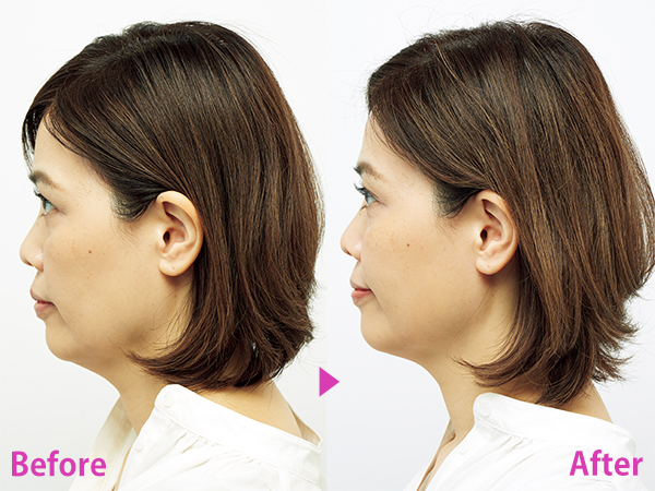 頭皮ケア美顔器】を40代50代がお試し！ビフォーアフター | 美ST ONLINE