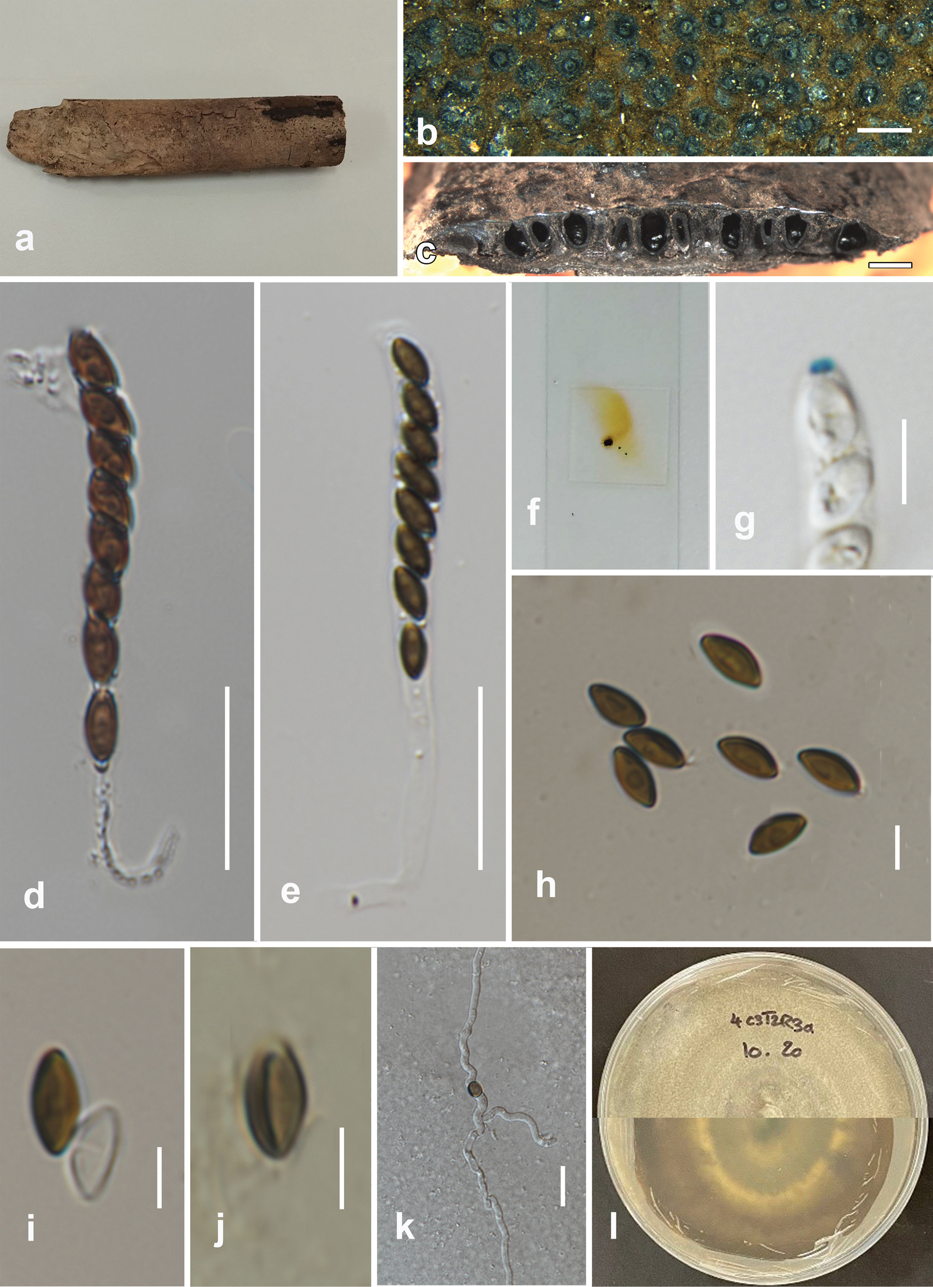 Novel discoveries of Xylariomycetidae (Ascomycota) taxa from peat