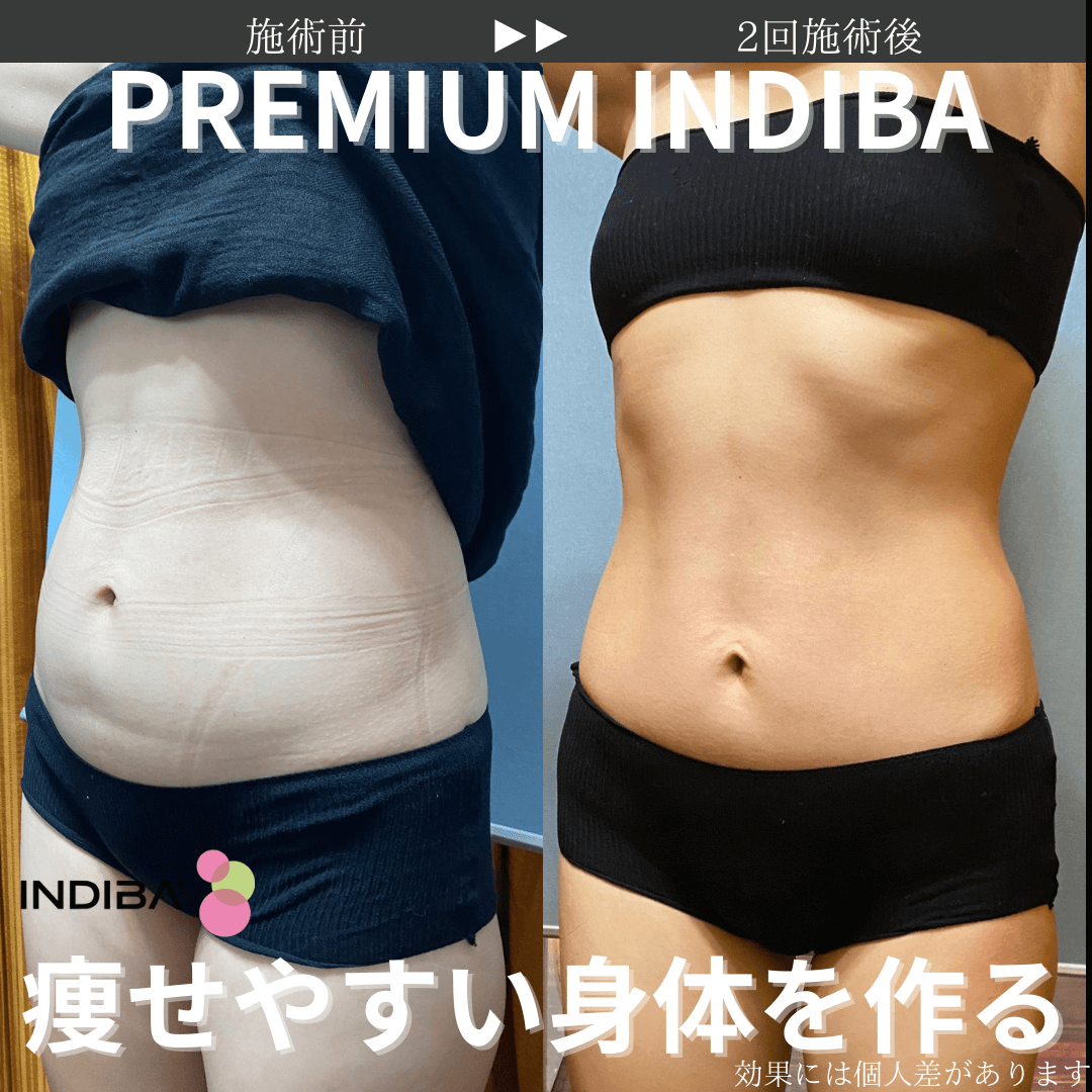 PREMIUM INDIBAについて - 美肌さいさい (Bihadasaisai)