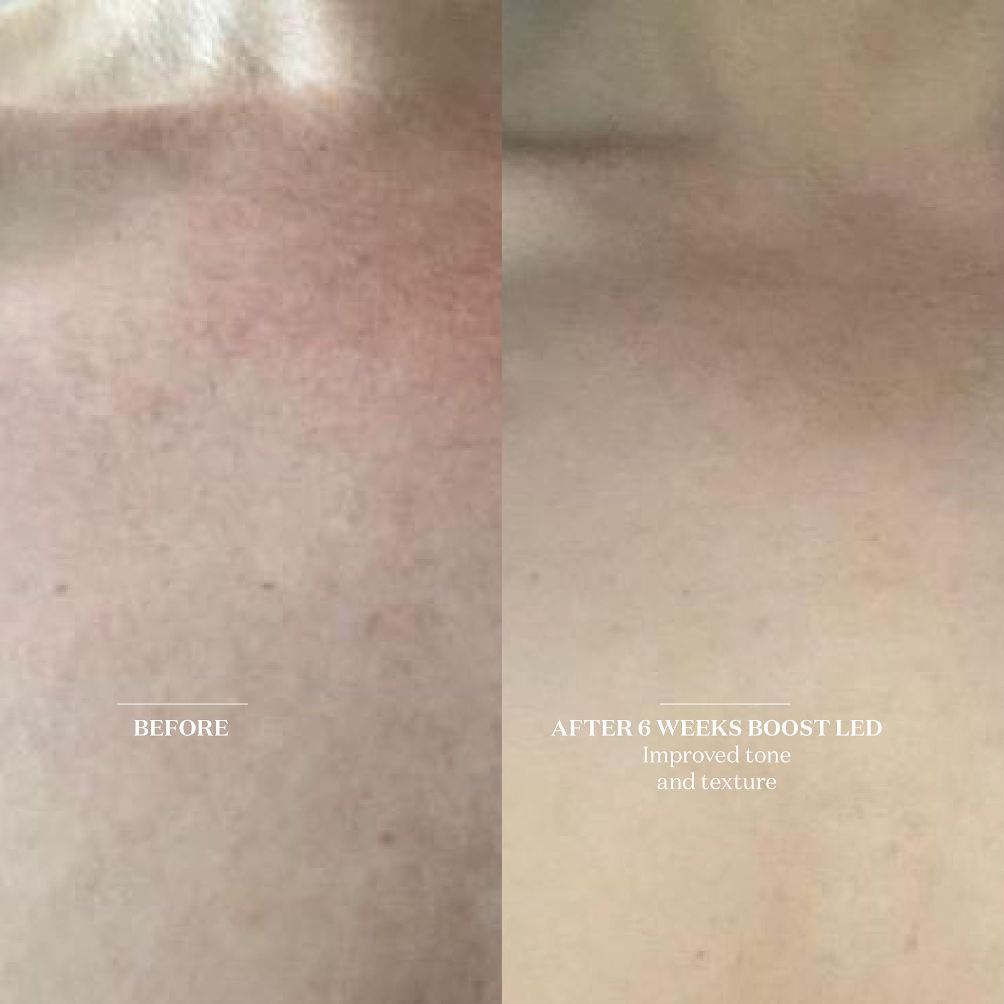 The Light Salon Boost LED Patch – The Light Salon – bluemercury