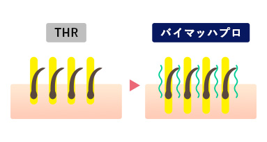 バイマッハプロの特徴・性能｜【公式】業務用脱毛機 BYMACH Pro（バイ