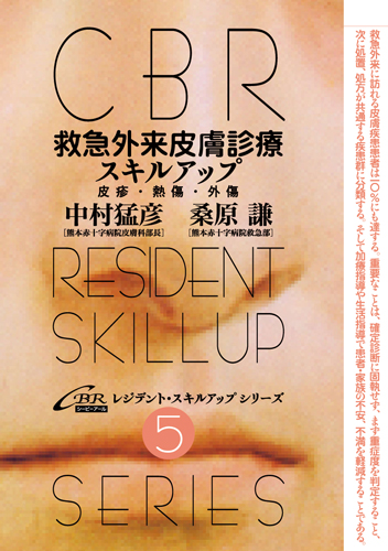 救急外来皮膚診療スキルアップ－皮疹・熱傷・外傷｜株式会社シービーアール