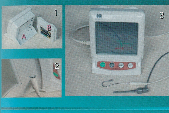 モリタ】ニッケルチタンファイルでの根管形成がエンドを変える
