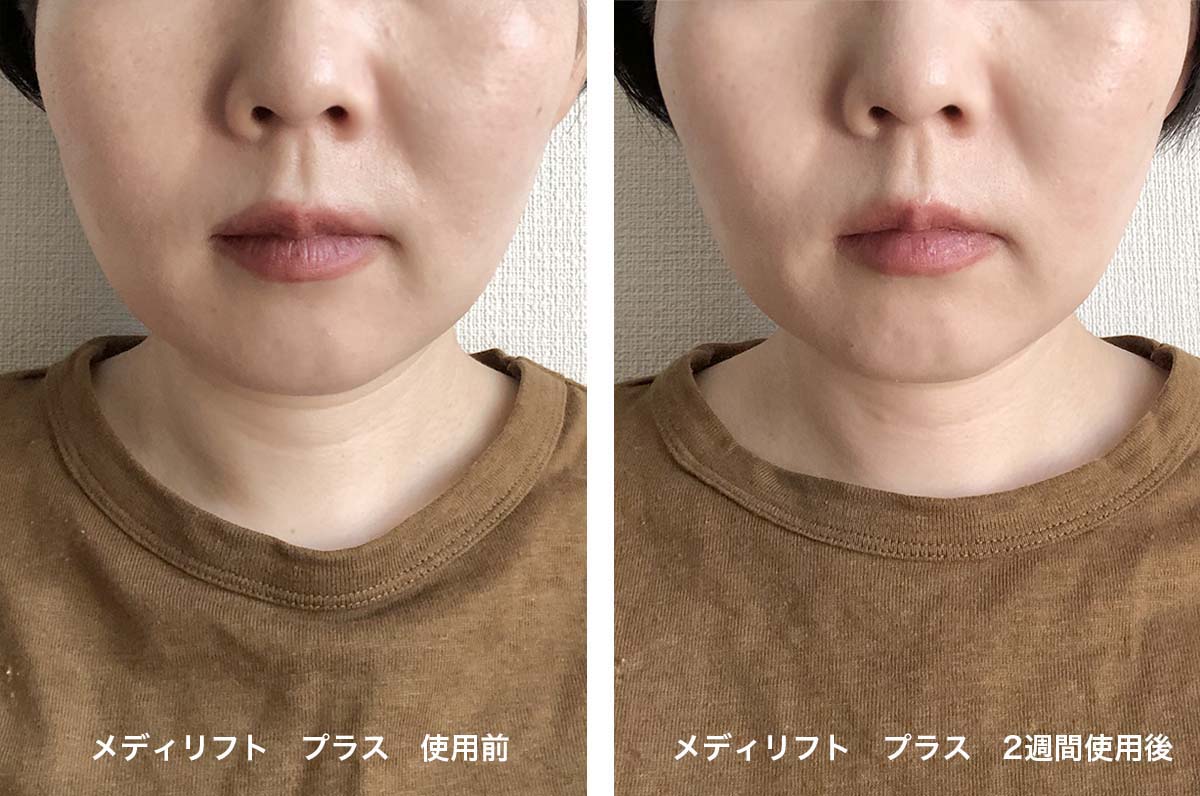 ヤーマン メディリフト 目もと専用3DウェアラブルEMS美顔器『メディ